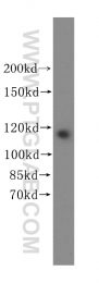 17170-1-AP - Isoleucyl-tRNA synthetase / IARS2