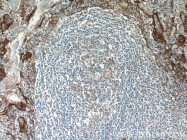10831-1-AP - CD54 / ICAM1