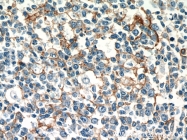10831-1-AP - CD54 / ICAM1