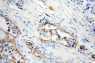 10831-1-AP - CD54 / ICAM1