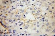 10831-1-AP - CD54 / ICAM1