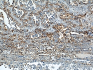10831-1-AP - CD54 / ICAM1