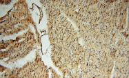 15364-1-AP - CD54 / ICAM1