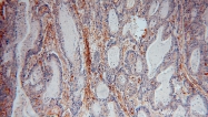 15364-1-AP - CD54 / ICAM1