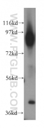 15364-1-AP - CD54 / ICAM1