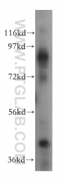 15364-1-AP - CD54 / ICAM1