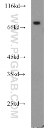 16174-1-AP - CD54 / ICAM1