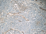 60299-1-Ig - CD54 / ICAM1