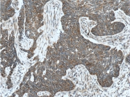 25848-1-AP - Isocitric dehydrogenase gamma / IDH3G