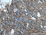 25848-1-AP - Isocitric dehydrogenase gamma / IDH3G