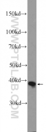25848-1-AP - Isocitric dehydrogenase gamma / IDH3G