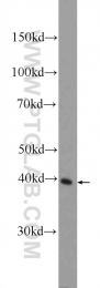 25848-1-AP - Isocitric dehydrogenase gamma / IDH3G