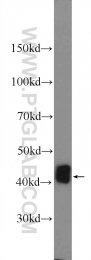 25848-1-AP - Isocitric dehydrogenase gamma / IDH3G