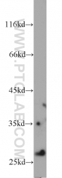 11166-2-AP - IPP isomerase 1 / IDI1