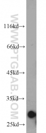 11166-2-AP - IPP isomerase 1 / IDI1