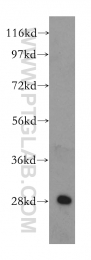 11166-2-AP - IPP isomerase 1 / IDI1