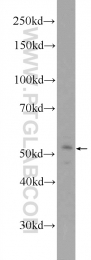 12604-1-AP - IFI54 / IFIT2