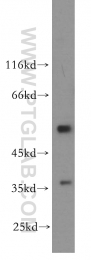 12939-1-AP - IFRD1