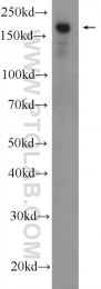 17460-1-AP - IFT140