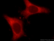 20214-1-AP - Insulin-like growth factor I / IGF1