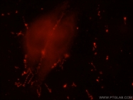 20214-1-AP - Insulin-like growth factor I / IGF1