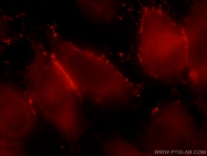 20214-1-AP - Insulin-like growth factor I / IGF1