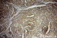 20214-1-AP - Insulin-like growth factor I / IGF1