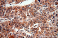 20214-1-AP - Insulin-like growth factor I / IGF1