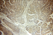 20214-1-AP - Insulin-like growth factor I / IGF1