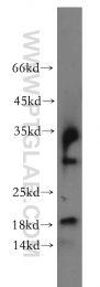 20214-1-AP - Insulin-like growth factor I / IGF1