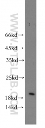 20214-1-AP - Insulin-like growth factor I / IGF1