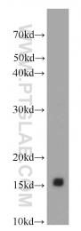 20214-1-AP - Insulin-like growth factor I / IGF1