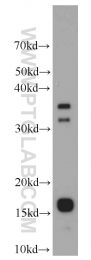 20214-1-AP - Insulin-like growth factor I / IGF1