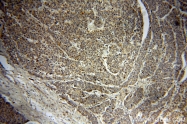 20215-1-AP - Insulin-like growth factor I / IGF1