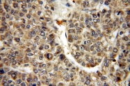20215-1-AP - Insulin-like growth factor I / IGF1