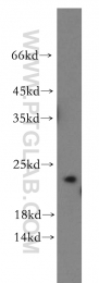 20215-1-AP - Insulin-like growth factor I / IGF1