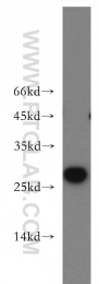 20215-1-AP - Insulin-like growth factor I / IGF1