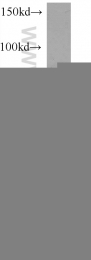 14642-1-AP - IGF2BP3 / IMP3