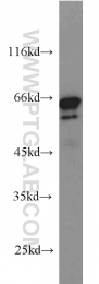 14642-1-AP - IGF2BP3 / IMP3