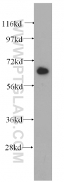 14642-1-AP - IGF2BP3 / IMP3