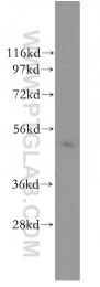 11449-1-AP - IGHG1