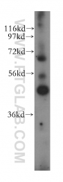 13388-1-AP - Indian hedgehog protein / IHH