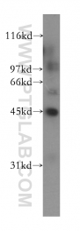 13388-1-AP - Indian hedgehog protein / IHH