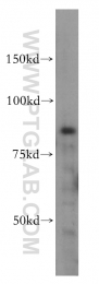 15649-1-AP - IKBKB / IKKB
