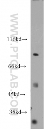 20979-1-AP - IKBKB / IKKB