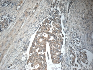 23705-1-AP - Interleukin-19 / IL19