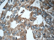 23705-1-AP - Interleukin-19 / IL19