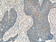 23705-1-AP - Interleukin-19 / IL19