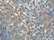 23705-1-AP - Interleukin-19 / IL19