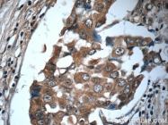 24402-1-AP - Interleukin-19 / IL19